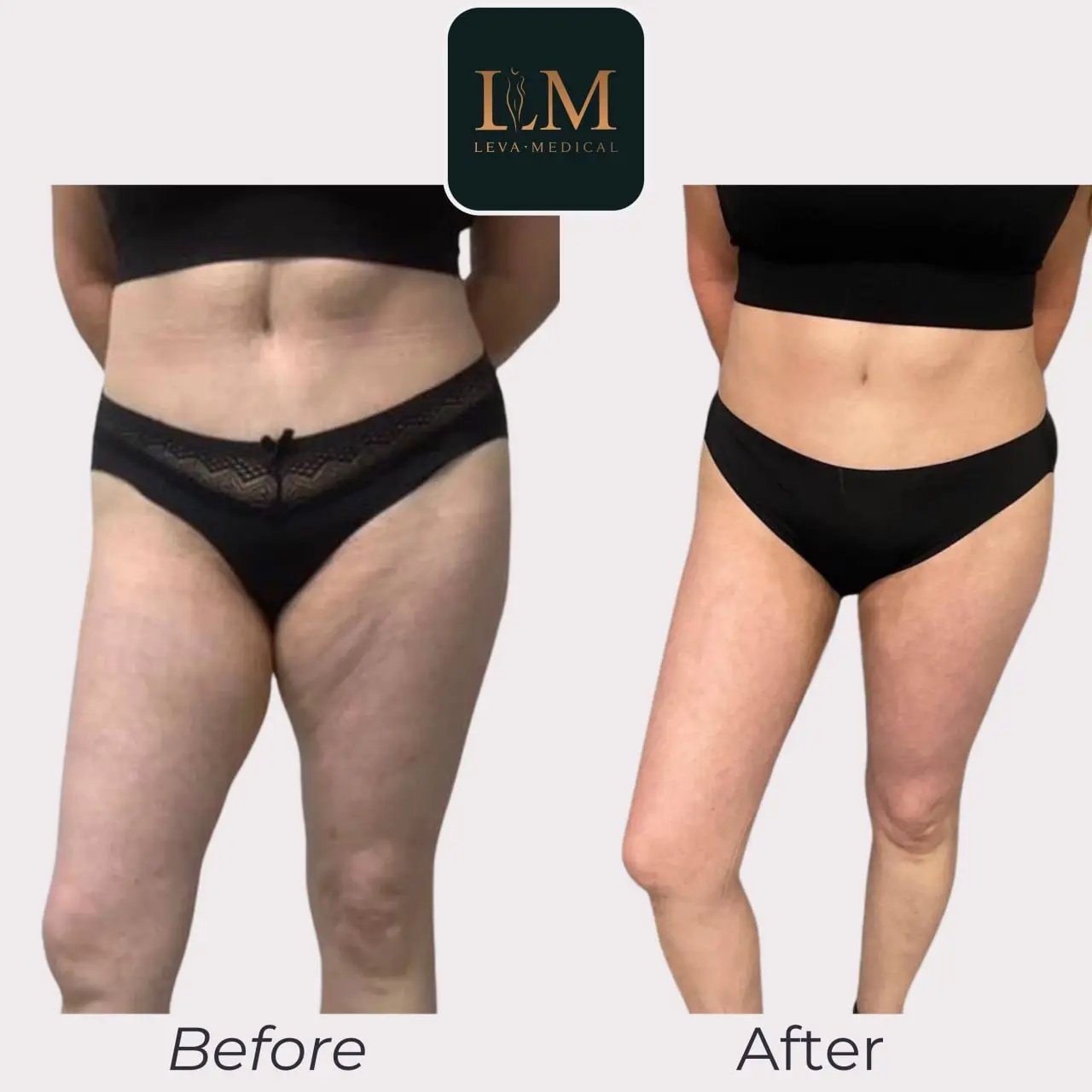 J Plasma Treatment 2
