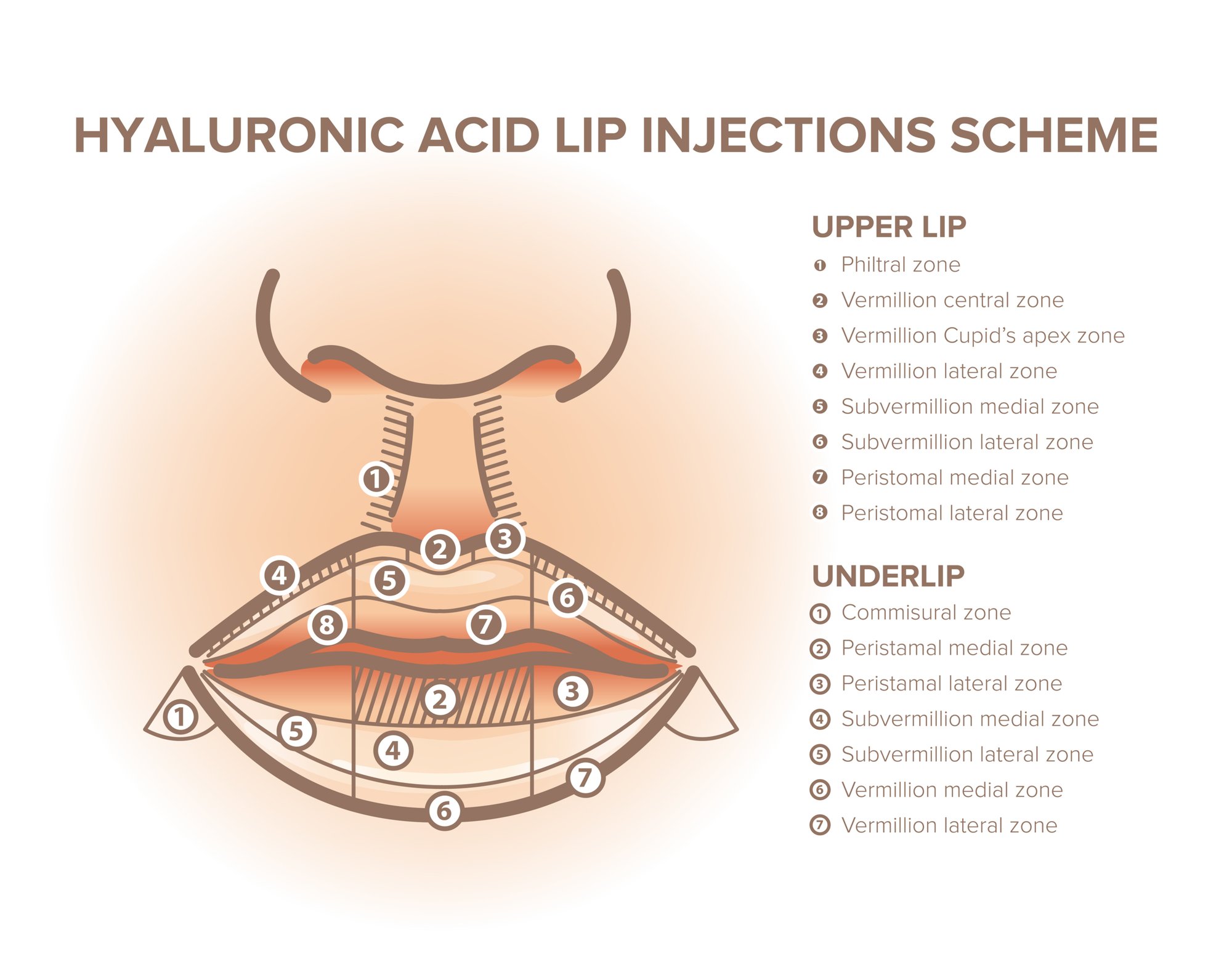 Top 10 Lip Filler Shapes to Enhance Your Natural Beauty1