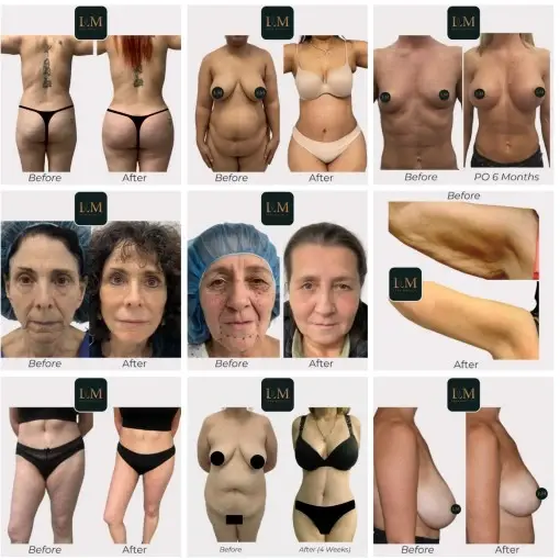Featured Image